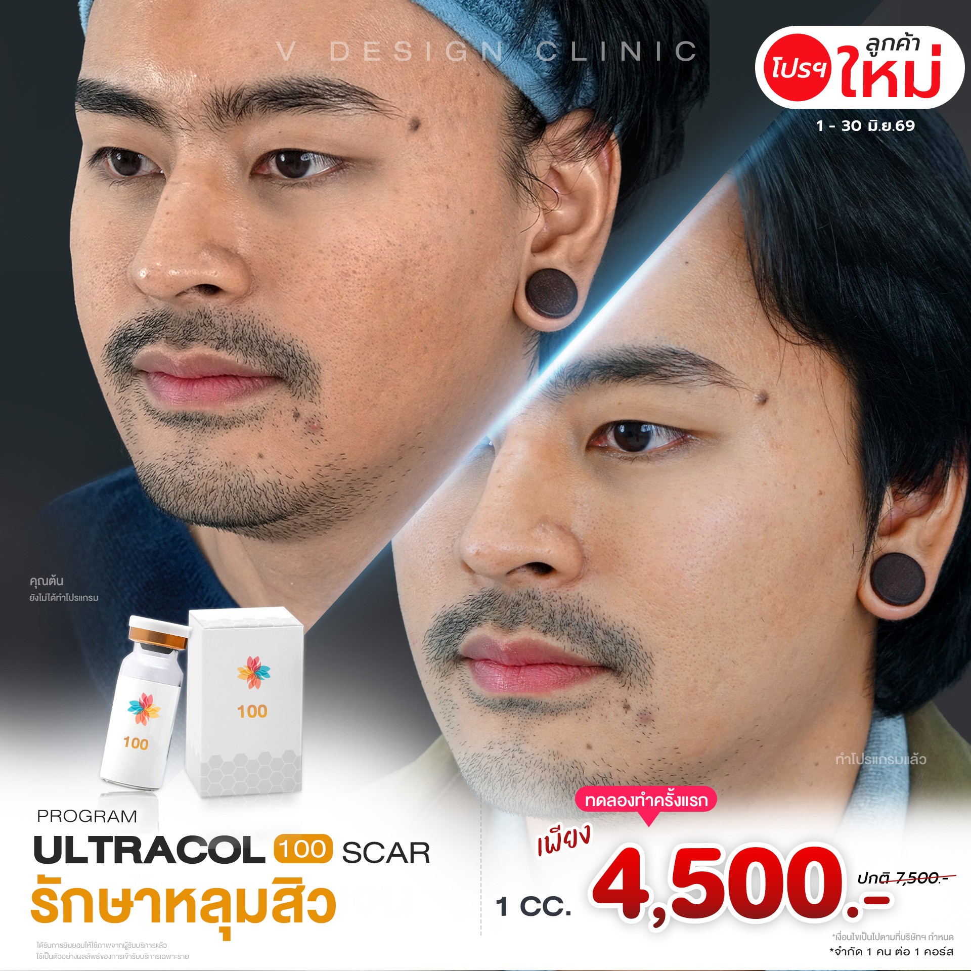 promotion img